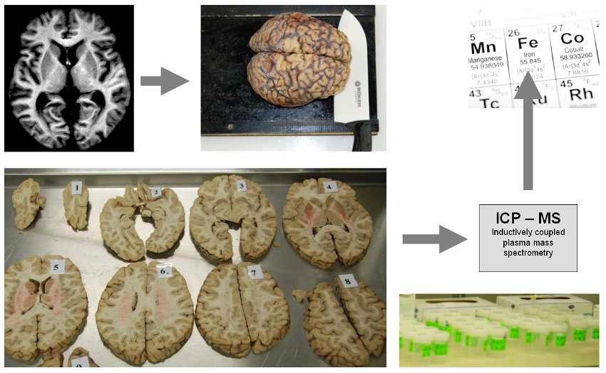 Validation of Iron mapping