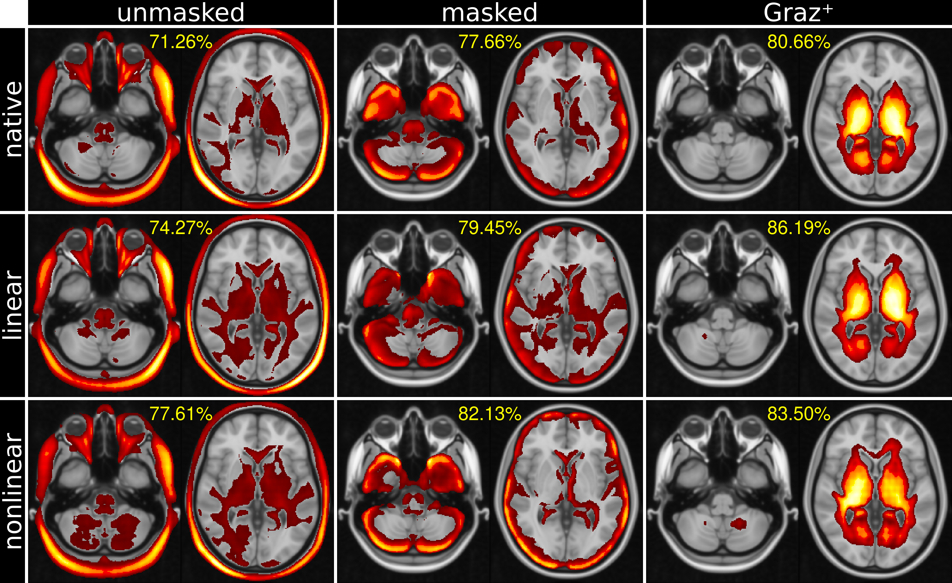 Explainable deep learning models for medical imaging | Neuroimaging ...